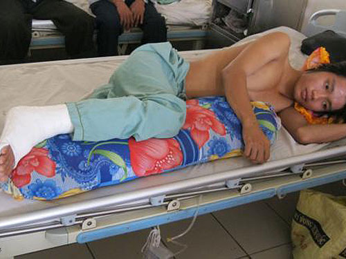 Anh Võ Trọng Khen sau tai nạn lao động bị liệt 2 chân đang điều trị tại Bệnh viện 115